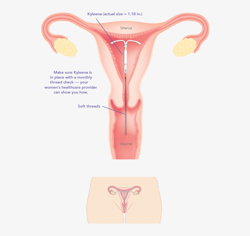 You - Copper T Family Planning Method, transparent png #4912771