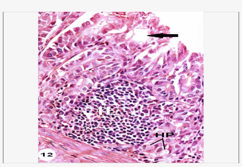 Cross Section Of Stomach Of Rat Treated With, transparent png #4912876