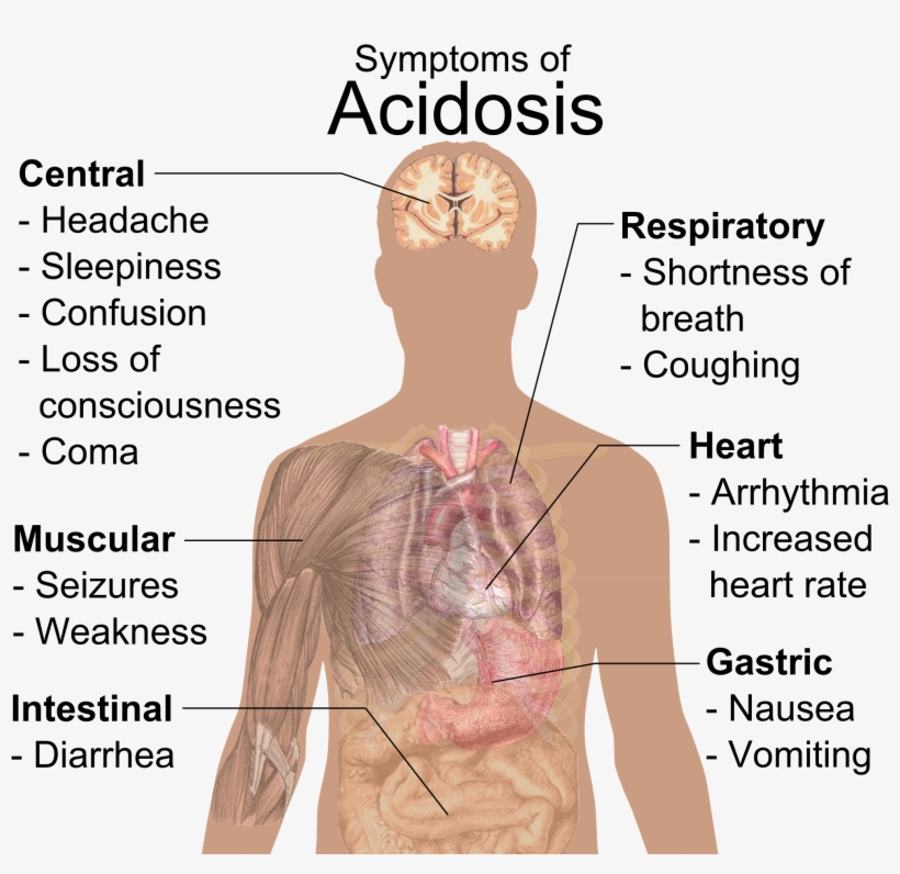 Symptoms Of Acidosis - Importance Of Ph In Daily Life, transparent png #4917034