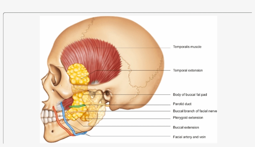 Anatomical Location Of The Buccal Fat Pad - Buccal Pad Of Fat, transparent png #4917582