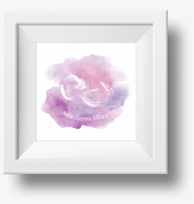 Baby Scan Watercolour Print - Picture Frame, transparent png #50227