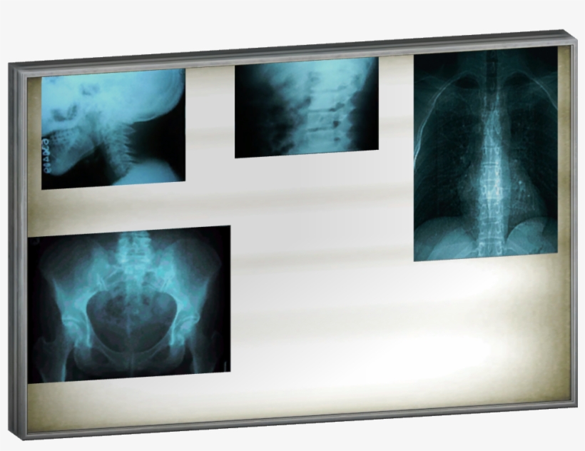 X-ray Lightbox - Light Box For X Rays, transparent png #51826