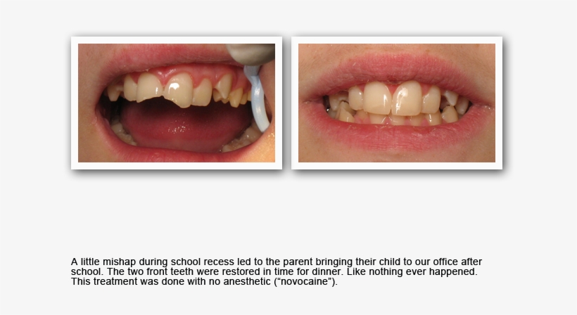 Gallery20 - Cosmetic Dentistry, transparent png #5013285