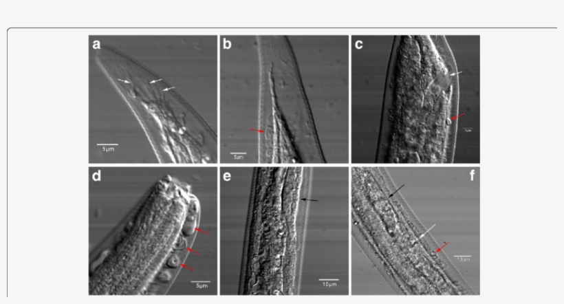 Morphological Features Of Haemonchus Contortus Larvae - Haemonchus Contortus, transparent png #5023375