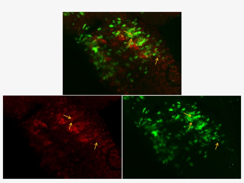 Entire Larva - - Graphic Design, transparent png #5024148