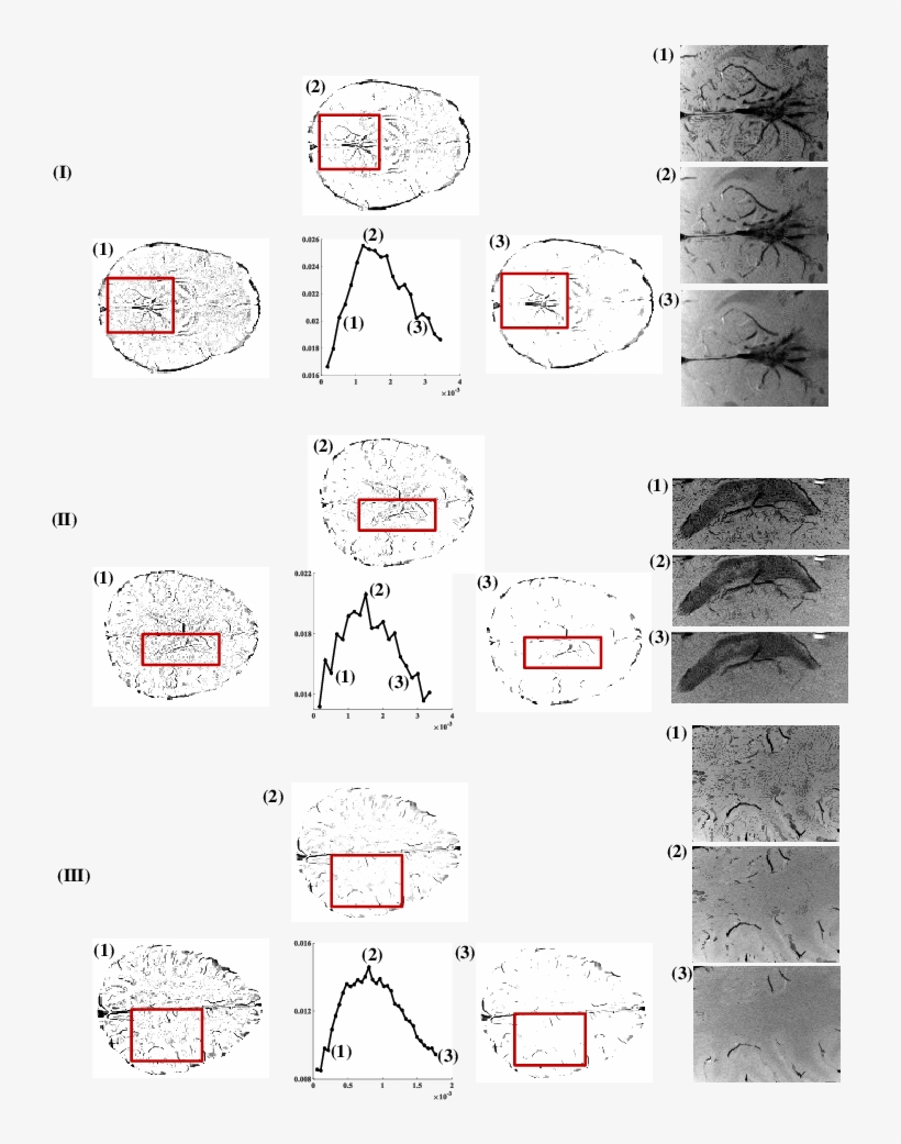 The Phase Masks Obtained Using Map Mrf Filter Is Shown - Data Set, transparent png #5047682