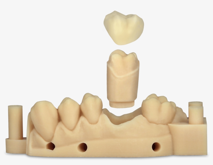 Try Watching This Video On Www - Dental Laboratory, transparent png #5086368