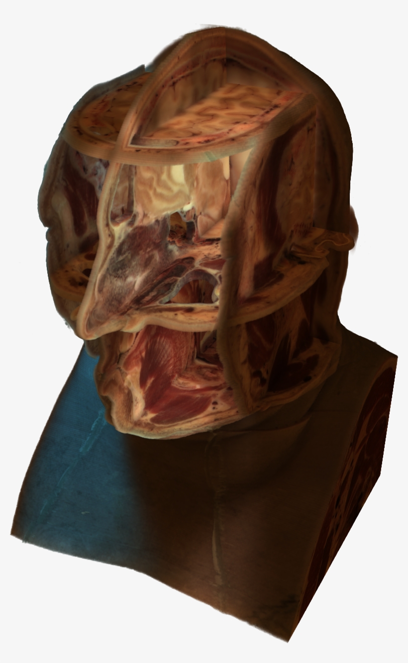 Cross-section Of A Human Head - Human Head, transparent png #5112487