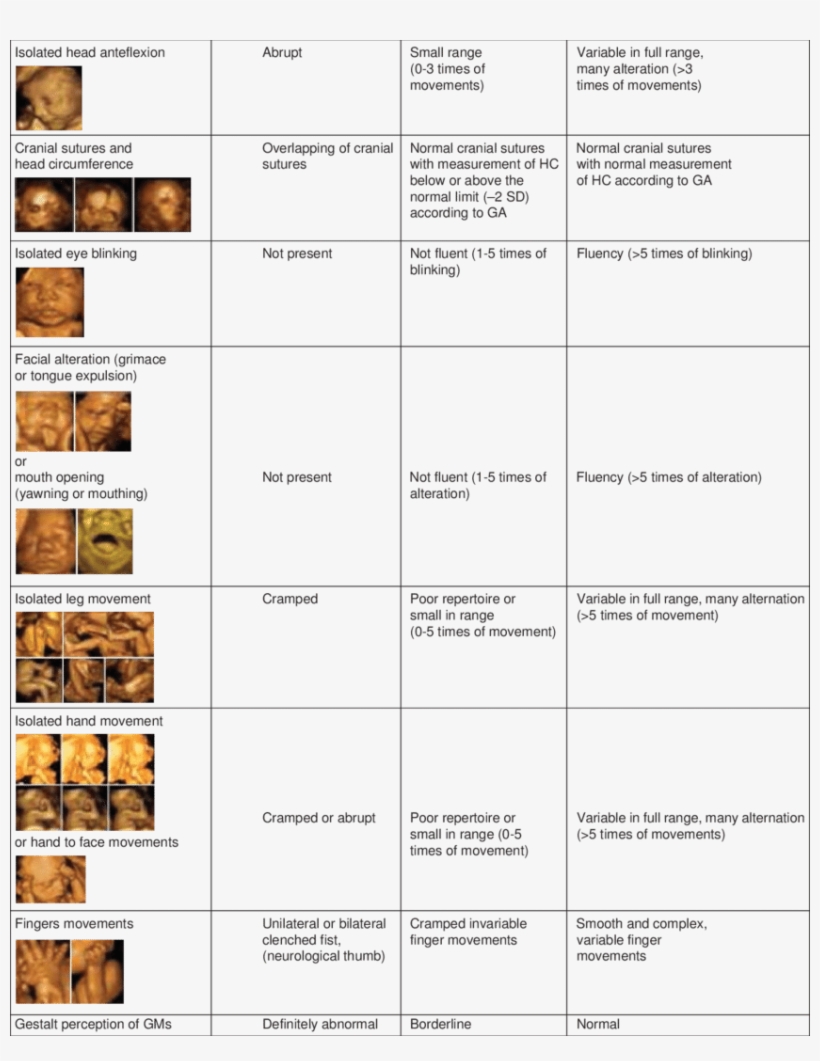 Kanet Uses A System Of 8 Fetal Structural And Behavioral - System, transparent png #5113241
