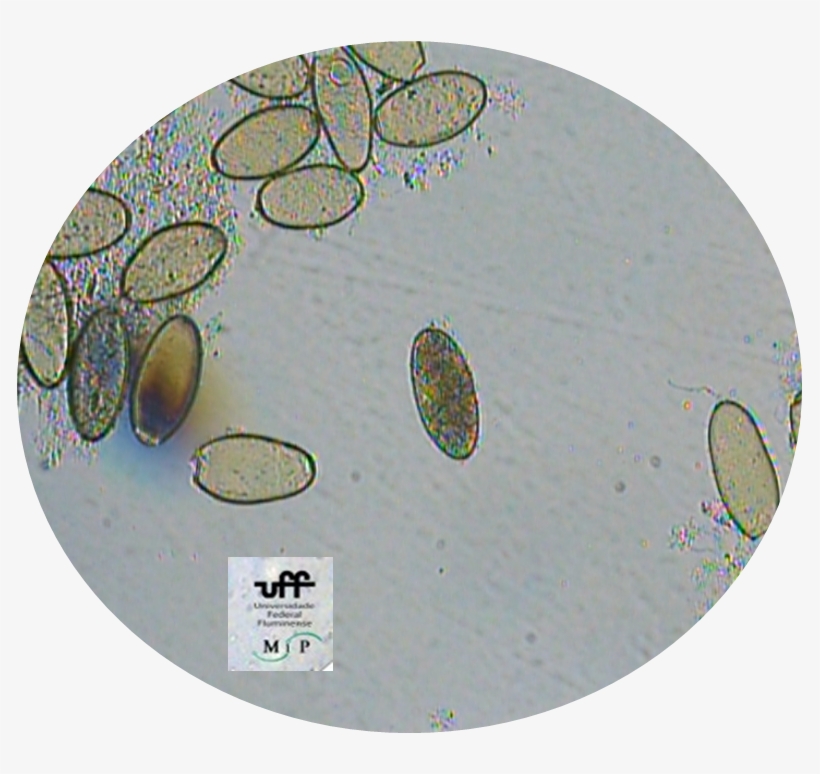 Ovo Fasciola 1 - Federal Fluminense University, transparent png #5121912
