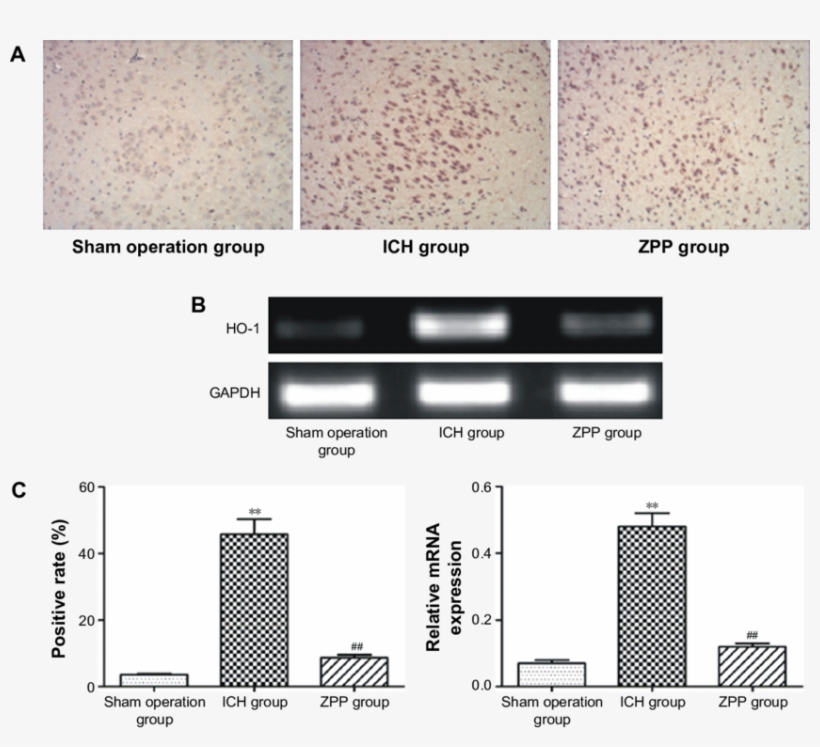 Effect Of Zpp On Brain Tissue Ho 1 Expression In Ich - Architecture, transparent png #5124575
