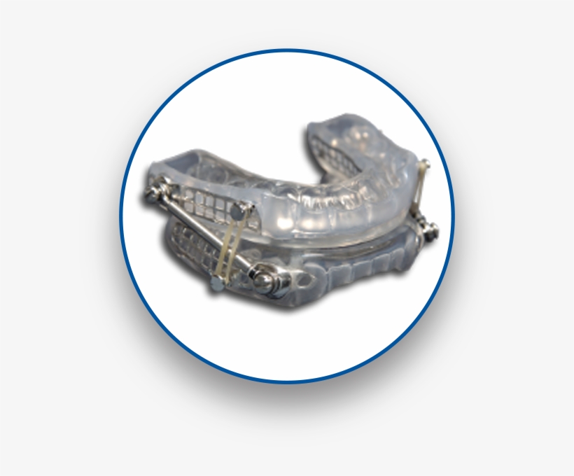 Suad Oral Appliance - Bronze, transparent png #5238662