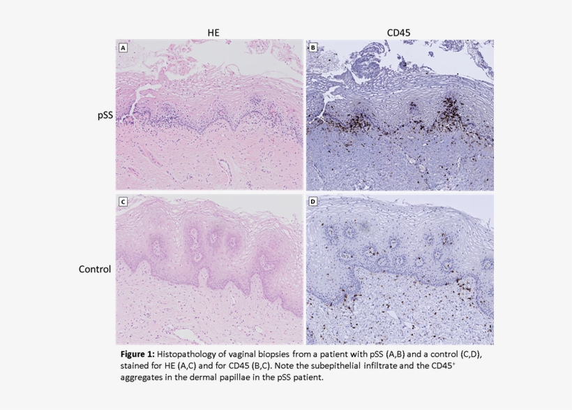 Beschrijving - Beschrijving - Beschrijving - Beschrijving - Mountain, transparent png #5263832