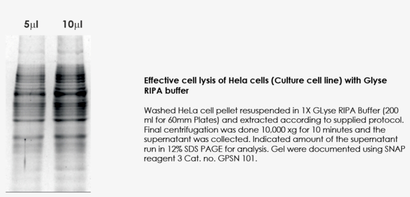 Glyse® Ripa Buffer Does Not Contain Any Kind Of Inhibitors - Ripa Buffer Pellet, transparent png #5297419