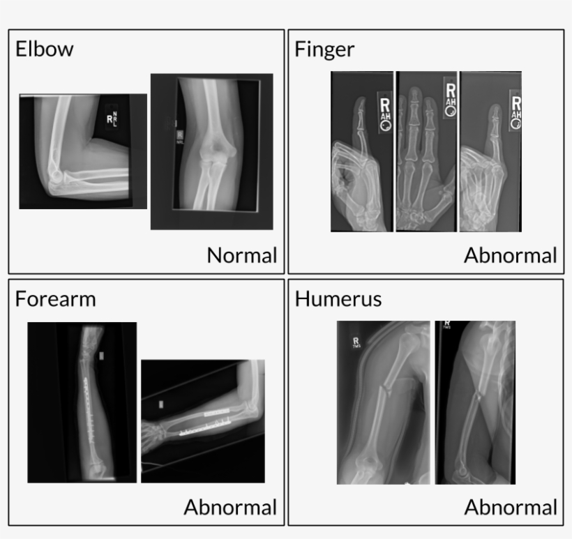 Aprendizaje Profundo Y Rayos X - X-ray, transparent png #535086