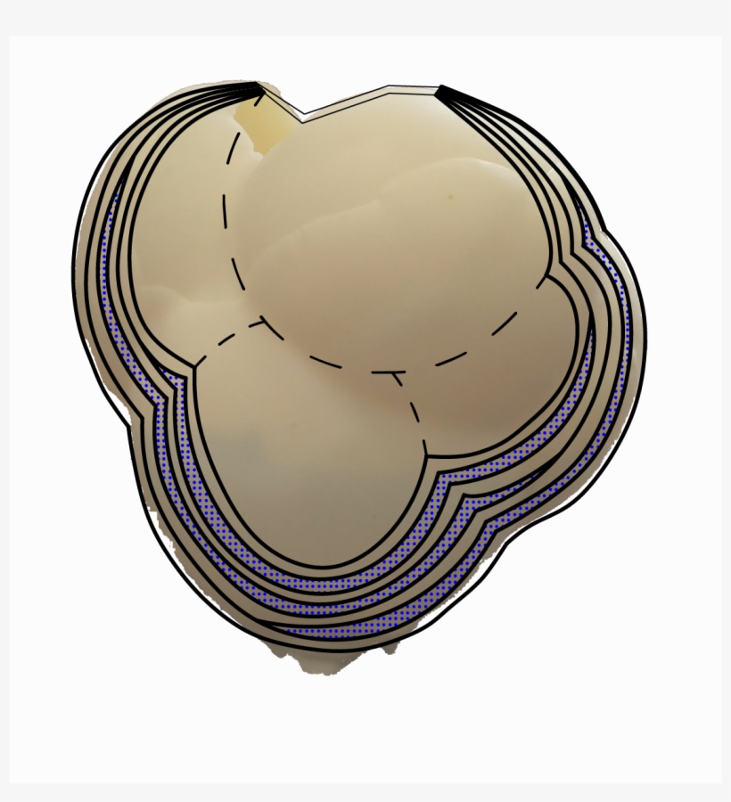 Plaster Layers Would Only Cover Half Of The Balloon, - Circle, transparent png #5389451