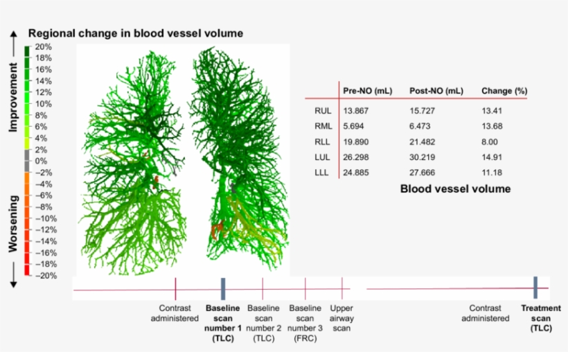 Frc, Functional Residual Capacity - Blood Vessel, transparent png #5399841