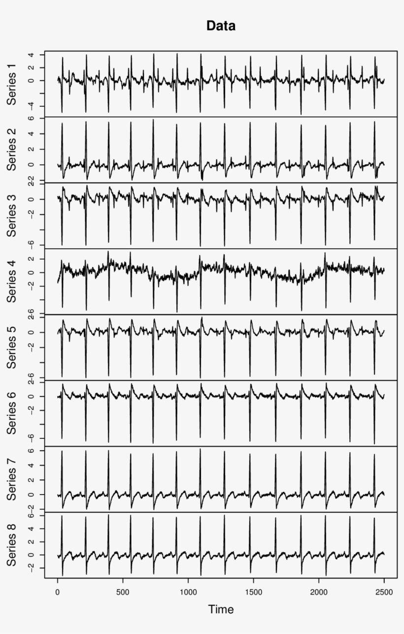 Electrocardiography Recordings Of A Pregnant Woman - Common Fig, transparent png #540093
