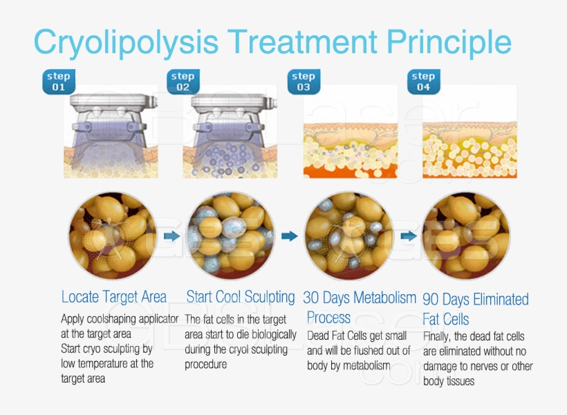 Best Coolsculption / Cryo Vacuum Cool Shape Body Slimming - Fat Cell Apoptosis, transparent png #5430006