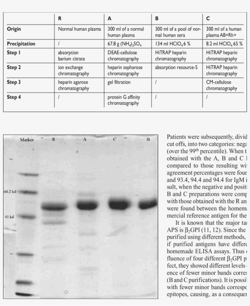Sds/page Of Different Β2gpi Preparations - Document, transparent png #5435540