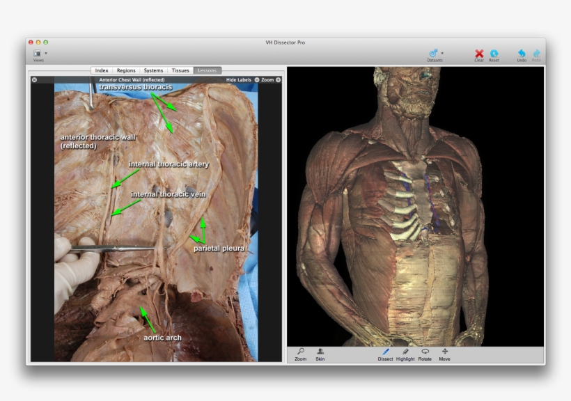 Step By Step Dissection Instructions - Anatomy, transparent png #5436387