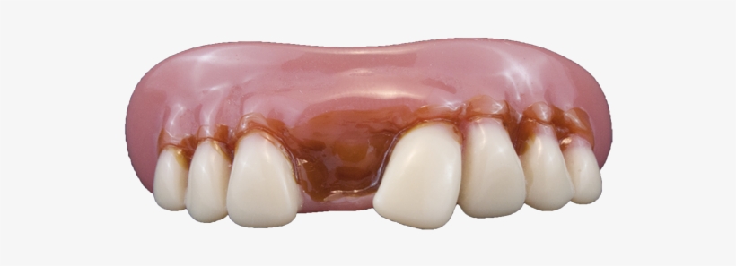 10481 Quarterbuck - Billy Bob Teeth 10481 Quarterbuck Fake Teeth, transparent png #555222