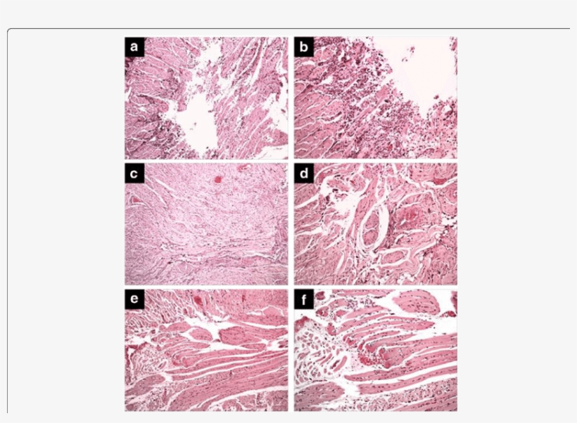 Effect Of Treatment With Copaiba Oil-resin On Transfixing - Motif, transparent png #5546645