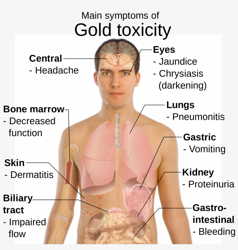Open - Pneumonia Sinais E Sintomas, transparent png #5569329