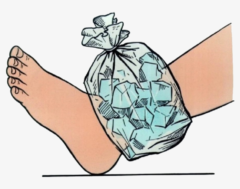 Free Library Ice Application To For - Ice On Injury Cartoon, transparent png #5591374
