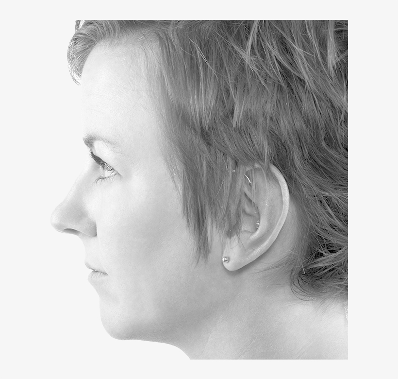 Microlaserpeel - Girl, transparent png #5615095