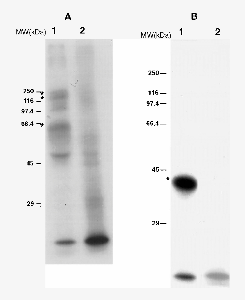 B Trypomastigote Forms From Cell Cultures - Monochrome, transparent png #5657205
