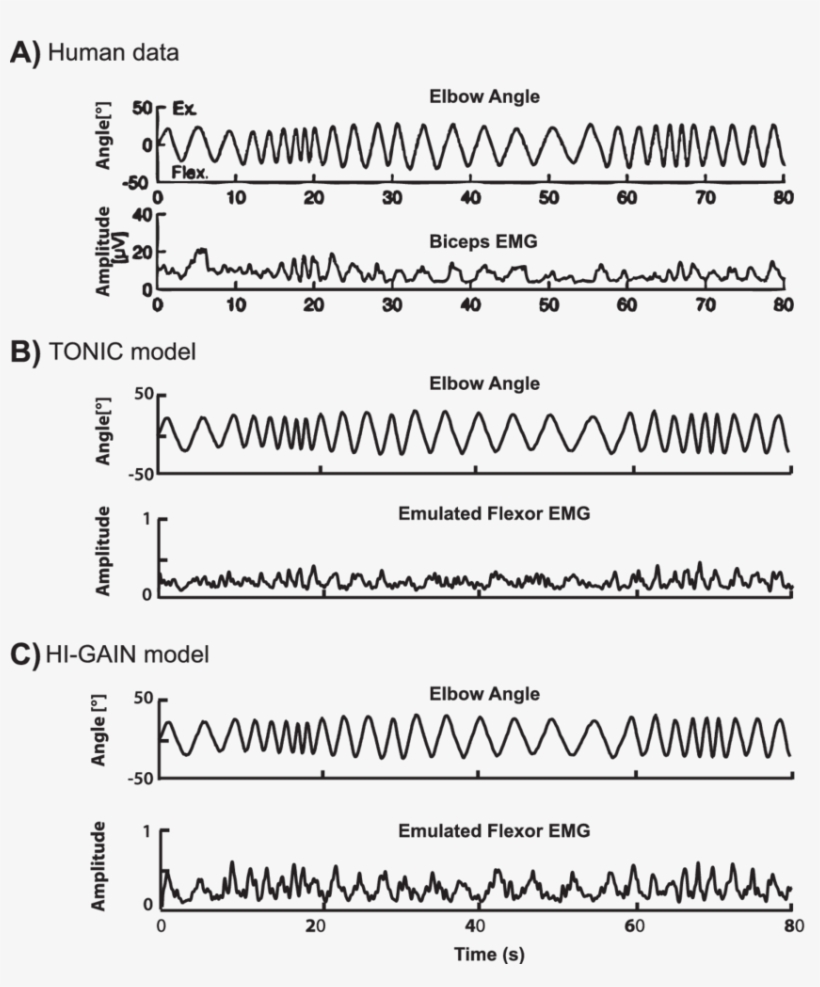 Biceps Emg During Arm Rotation In A Child With Hypertonic, transparent png #5663857