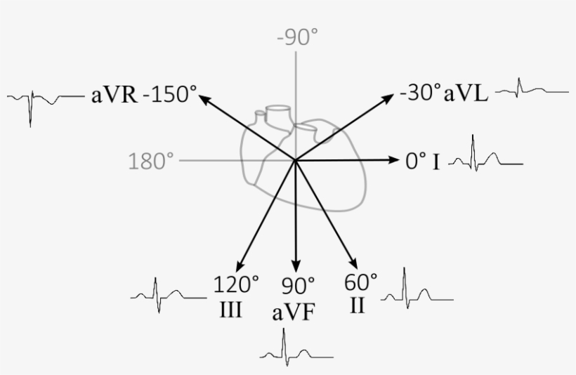 Cardiac Vector Ekg Jpg Black And White Download - Diagram, transparent png #574700