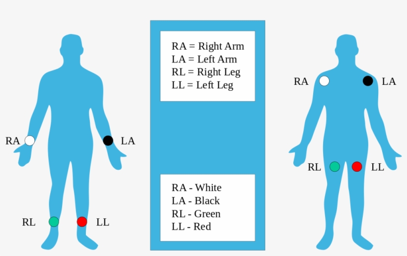 The 12-lead Ecg Electrode Placement Is Essential For - Modified Limb Lead Placement, transparent png #575290