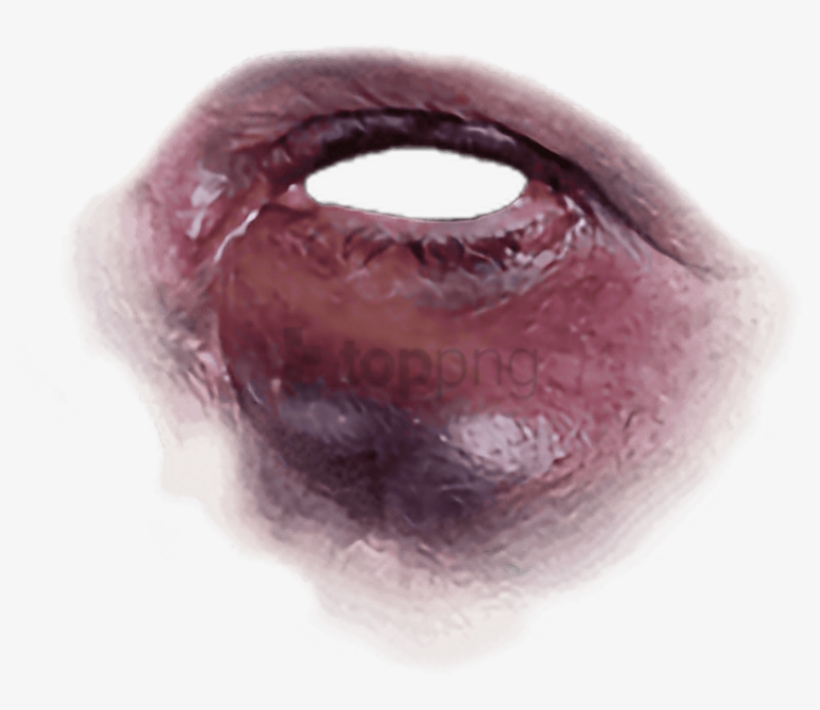 Black Eye Freetoedit - Black Eye Bruise Png, transparent png #579267