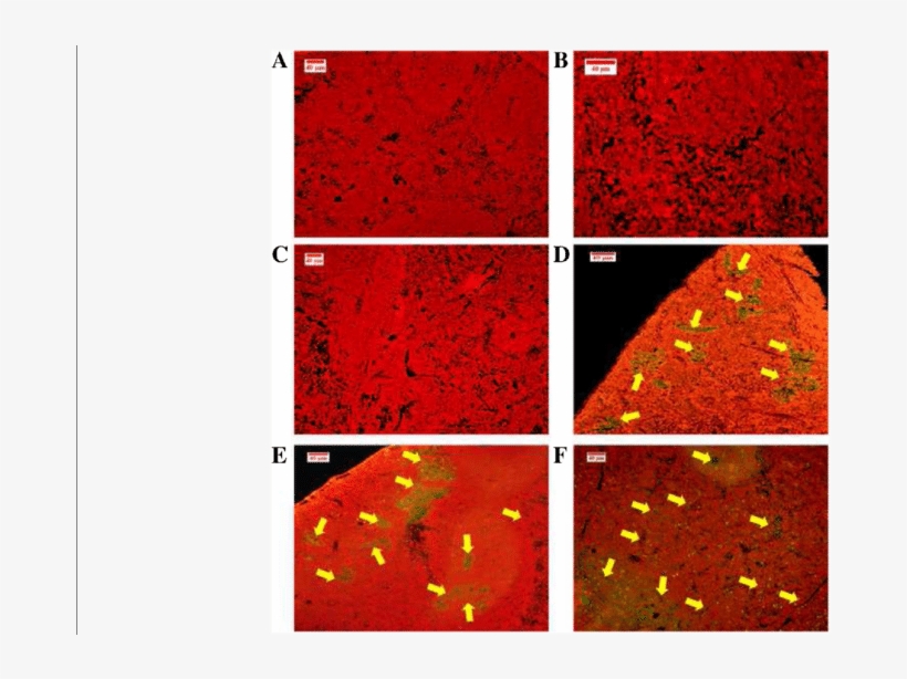 Tunel Assay Used To Detect The Apoptotic Cells In Spleen - Common Fig, transparent png #5714672