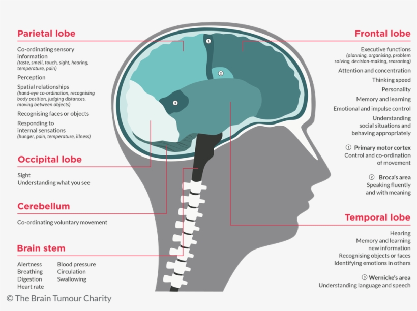 Symptoms Based On Brain Tumour Location The Brain Tumour - Brain Tumor, transparent png #5726380