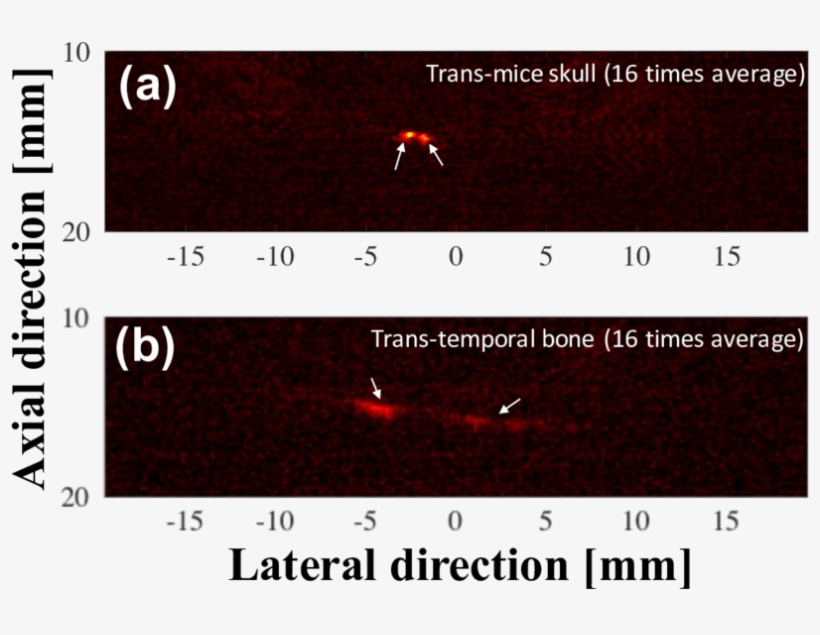 Preliminary Ex Vivo Photoacoustic Imaging Results For - Photoacoustic Imaging, transparent png #5752683