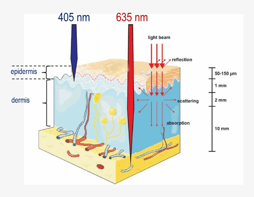 The Principle Of Photodynamic Therapy And Commonly - Penetration In Red Light, transparent png #5773578