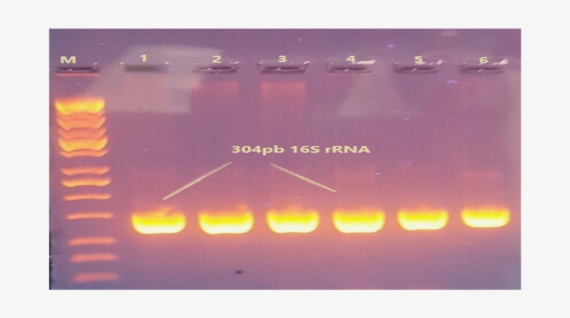 Agarose Gel Electrophoresis Of Amplified 16 Srrna Gene - Agarose Gel 16s, transparent png #5788935