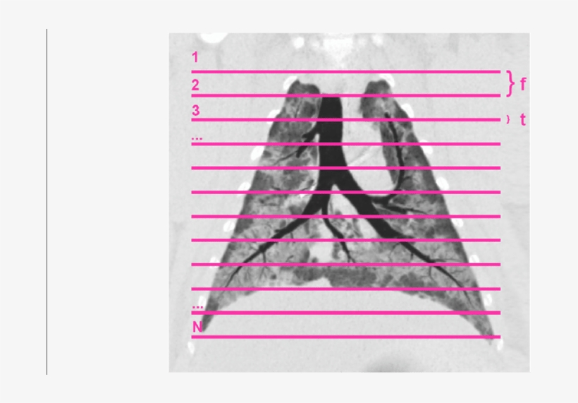 Coronal Plane Reconstruction Of A Representative Animal - Coronal Plane, transparent png #5838790