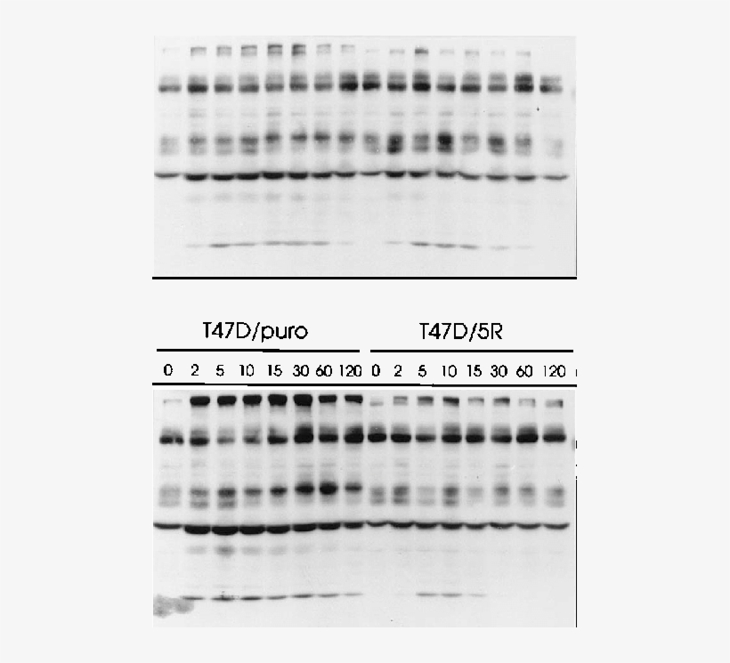 Total Phosphotyrosine Blot Of Egf And Ndf Induced T47d/puro - Monochrome, transparent png #5852075