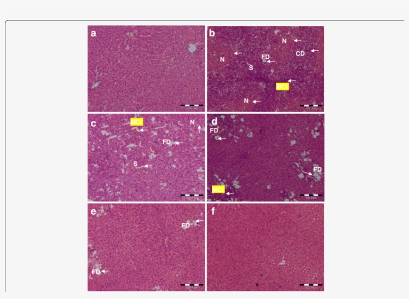 Effect Of C - Histopathology, transparent png #5885568