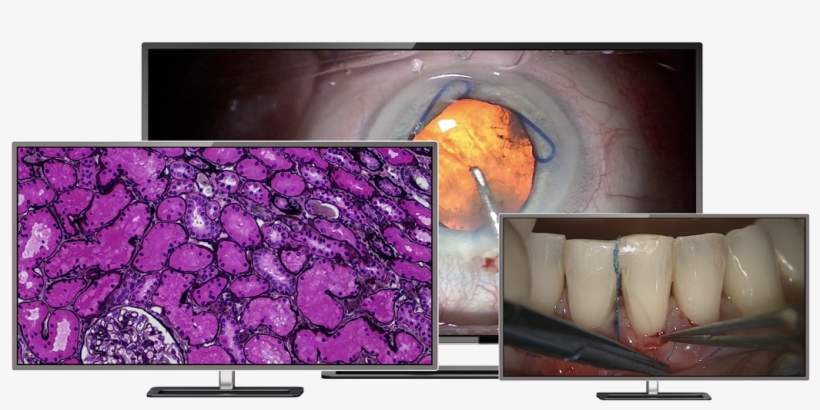 Large 4k Uhd Monitors For Displaying Pathology, Ophthalmology, - Led-backlit Lcd Display, transparent png #5918496