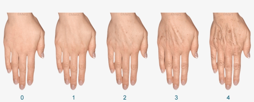 How Do You Rate Your Hands - Hands Filler, transparent png #5947645