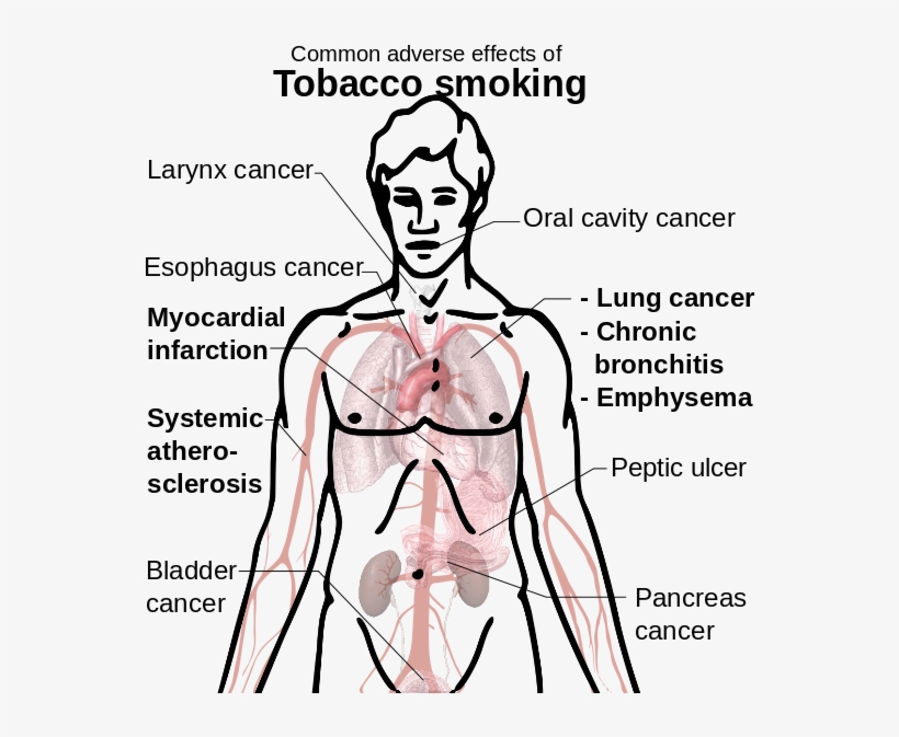 Drawn Cigarette Effect Tobacco, transparent png #5966566