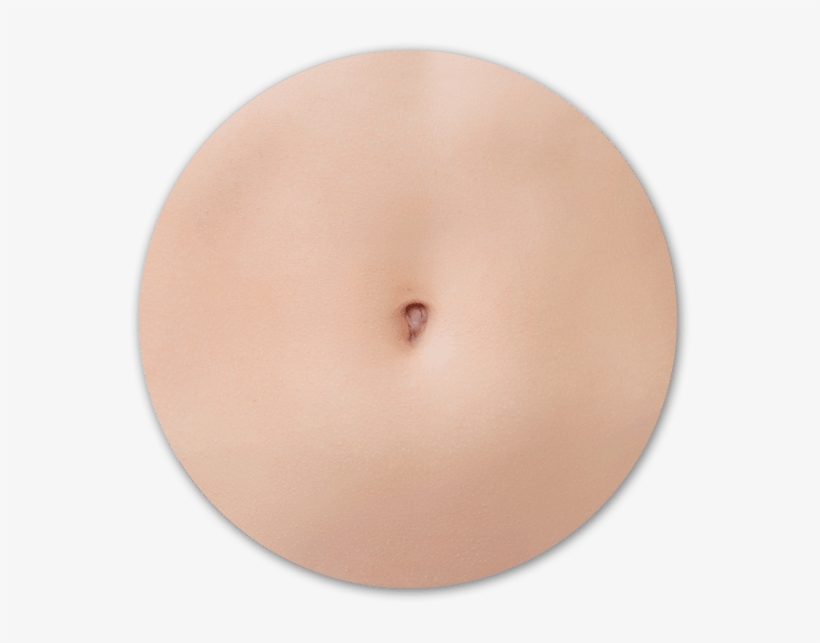 Belly Button Surgery Surrey - Umbilicoplasty, transparent png #5991089