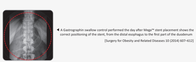 C-8[1] - Computed Tomography, transparent png #5999400