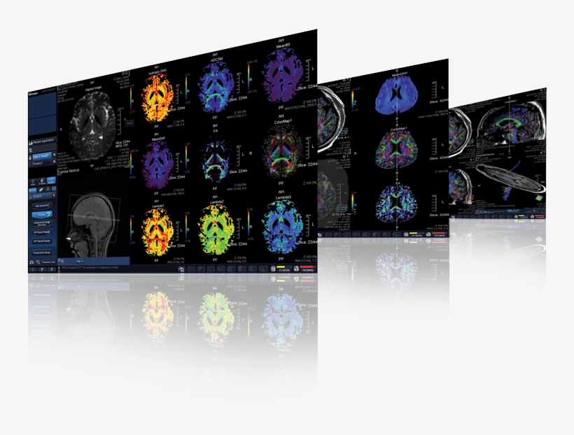 M-power Technology - Magnetic Resonance Imaging, transparent png #6096420
