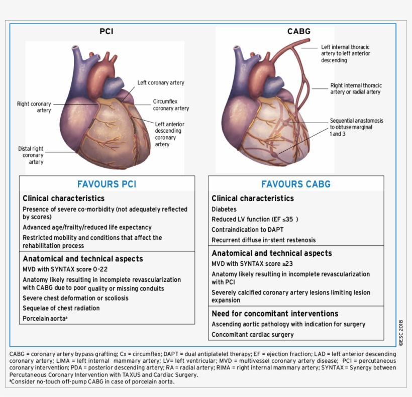 Aspects To Be Considered By The Heart Team For Decision-making - Coronary Artery Bypass Surgery, transparent png #6130101